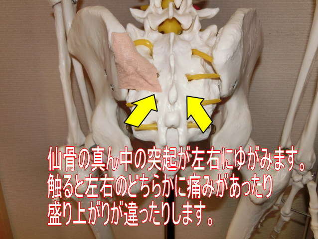 仙骨の痛み　仙骨調整　仙骨が痛い　仙骨が腰痛の原因　仙骨がゆがむ