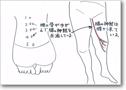 和歌山市　海南市　有田市　膝の痛み治療　あぐらがかけない理由