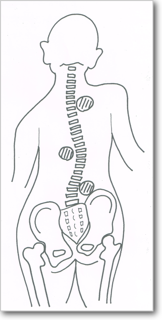 背骨ゆがみ　骨格　骨盤　頸椎　胸椎　腰椎　脊柱